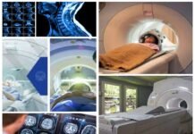 MRI SCAN : जानिए क्या है मैग्नेटिक रिजनेंस इमेजिंग (एमआरआई) mri scan : जानिए क्या है मैग्नेटिक रिजनेंस इमेजिंग (एमआरआई)